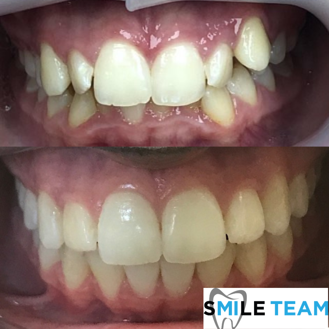 smile-gallery gallery