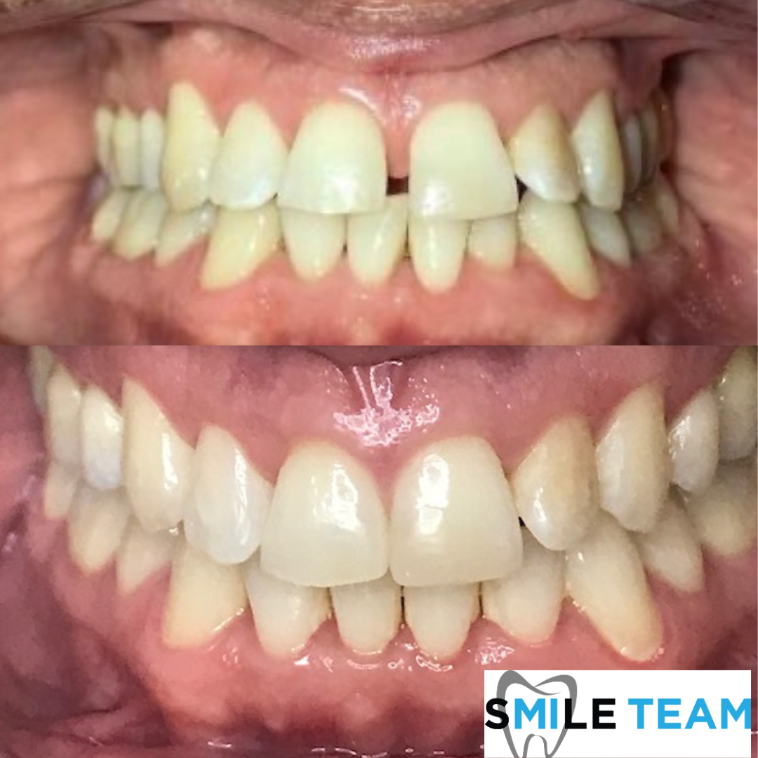 smile-gallery gallery