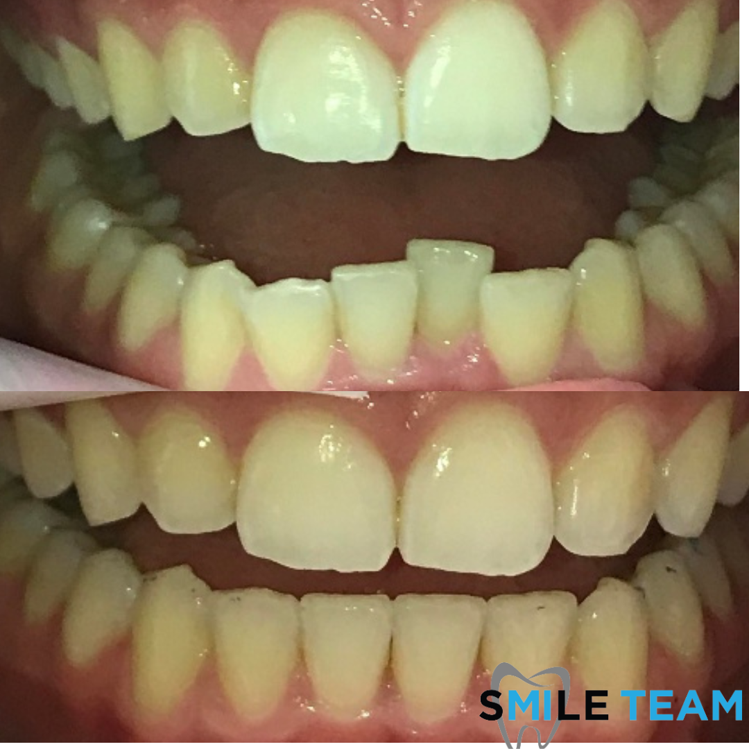 smile-gallery gallery