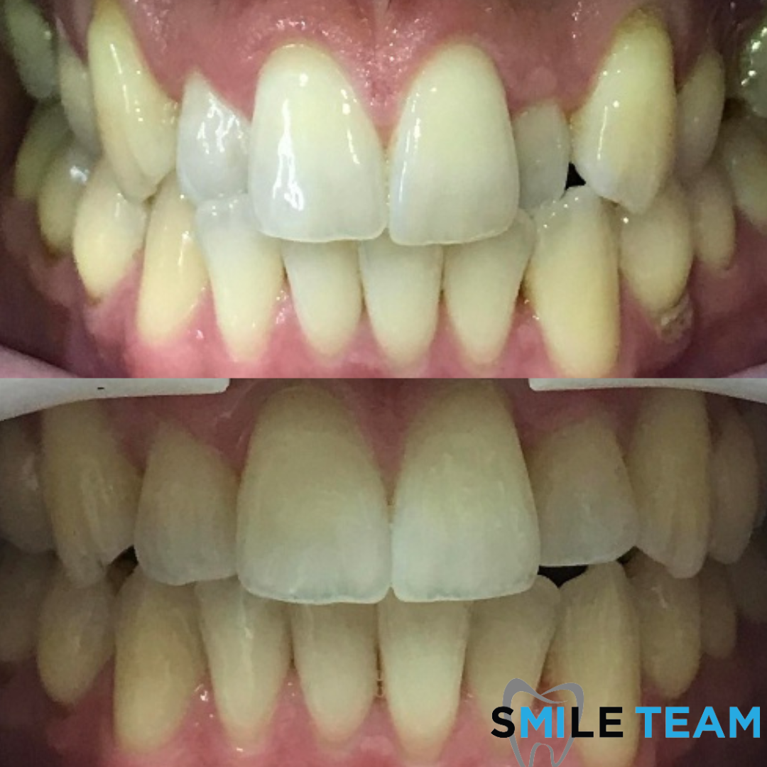 smile-gallery gallery