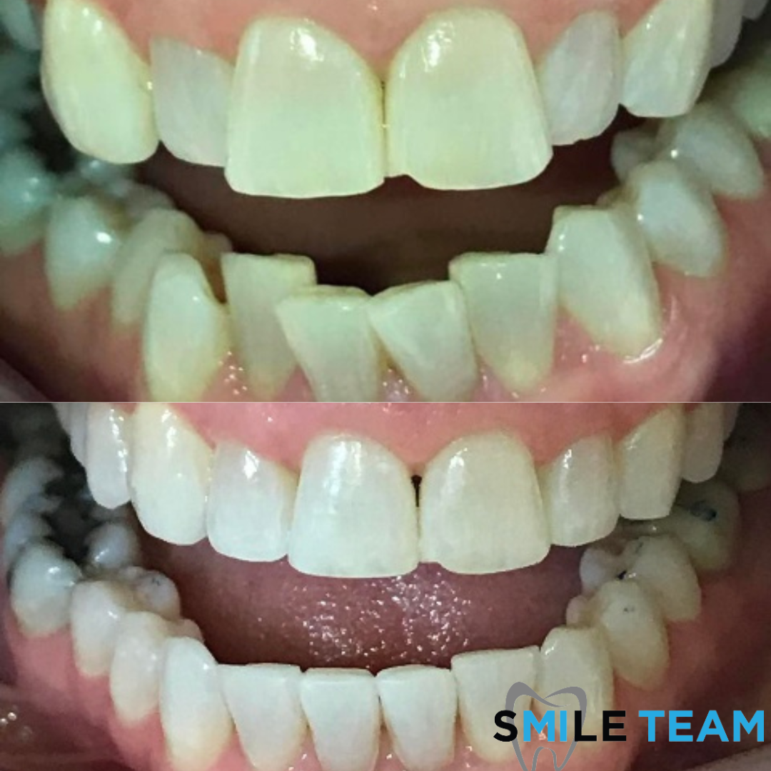 smile-gallery gallery