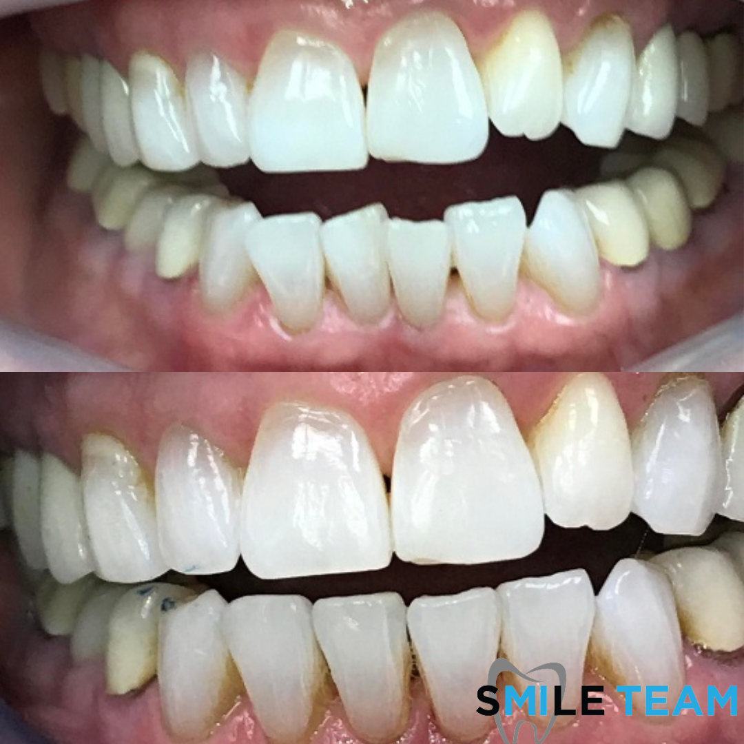 smile-gallery gallery